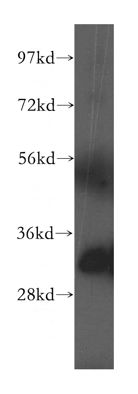 human heart tissue were subjected to SDS PAGE followed by western blot with Catalog No:110648(Fhl1 antibody) at dilution of 1:300