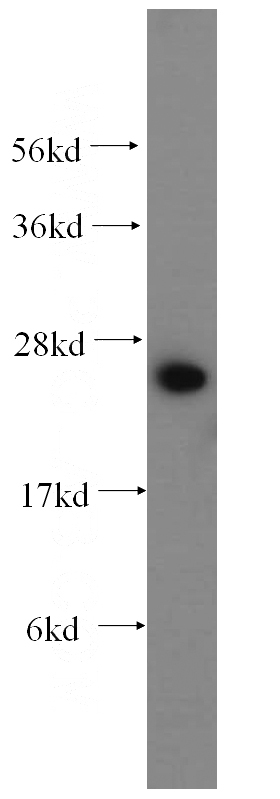 mouse liver tissue were subjected to SDS PAGE followed by western blot with Catalog No:111179(GSTA1 antibody) at dilution of 1:400