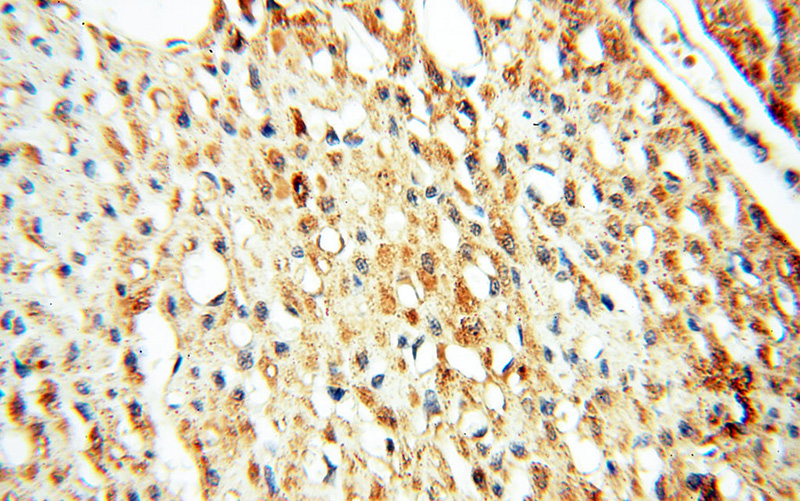 Immunohistochemical of paraffin-embedded human heart using Catalog No:115157(SFTPB antibody) at dilution of 1:50 (under 40x lens)