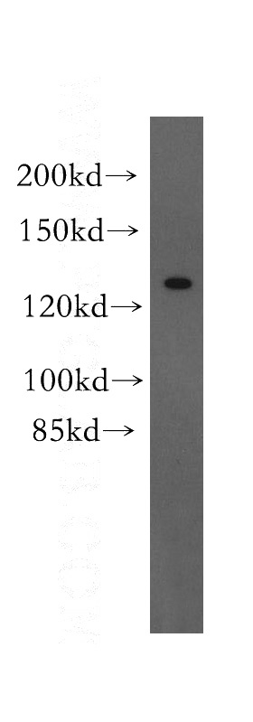 mouse brain tissue were subjected to SDS PAGE followed by western blot with Catalog No:110803(GABBR1 antibody) at dilution of 1:500