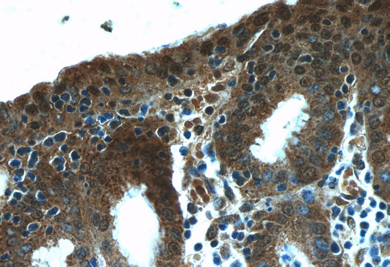 Immunohistochemistry of paraffin-embedded human stomach slide using Catalog No:113377(NUP205 Antibody) at dilution of 1:50