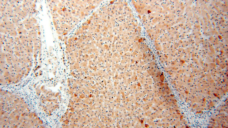 Immunohistochemical of paraffin-embedded human liver using Catalog No:113877(PI4K2B antibody) at dilution of 1:100 (under 10x lens)
