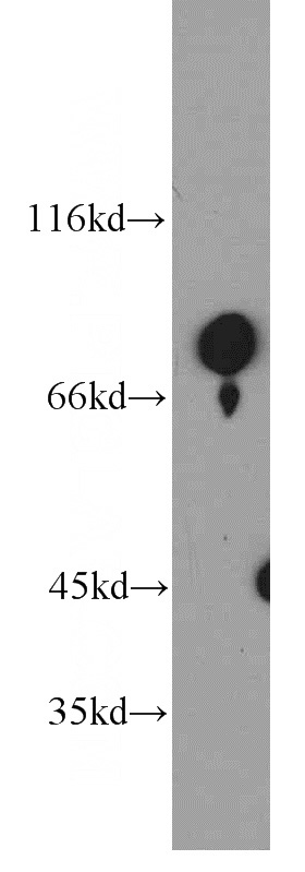 human testis tissue were subjected to SDS PAGE followed by western blot with Catalog No:112616(MIER1 antibody) at dilution of 1:500