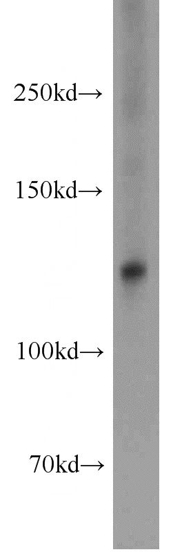 Jurkat cells were subjected to SDS PAGE followed by western blot with Catalog No:114608(RBM26 antibody) at dilution of 1:1000