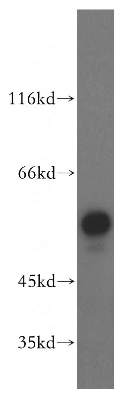 Jurkat cells were subjected to SDS PAGE followed by western blot with Catalog No:110681(FKBP8 antibody) at dilution of 1:500