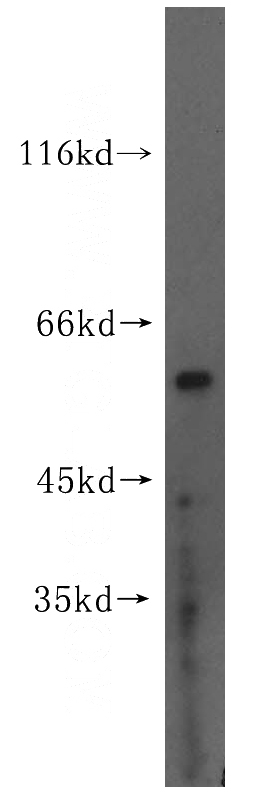 HeLa cells were subjected to SDS PAGE followed by western blot with Catalog No:112647(MAP2K5 antibody) at dilution of 1:400