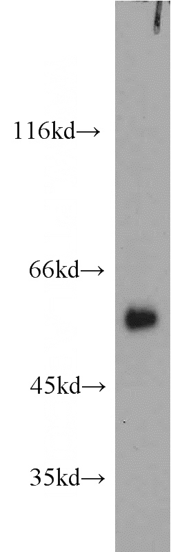 mouse testis tissue were subjected to SDS PAGE followed by western blot with Catalog No:115554(SPATA6 antibody) at dilution of 1:800