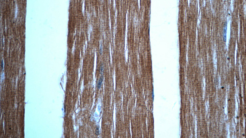 Immunohistochemistry of paraffin-embedded human skeletal muscle tissue slide using Catalog No:112993(MYOM1-Specific Antibody) at dilution of 1:50 (under 40x lens)