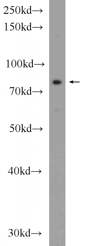 HeLa cells were subjected to SDS PAGE followed by western blot with Catalog No:112167(LCA5 Antibody) at dilution of 1:300