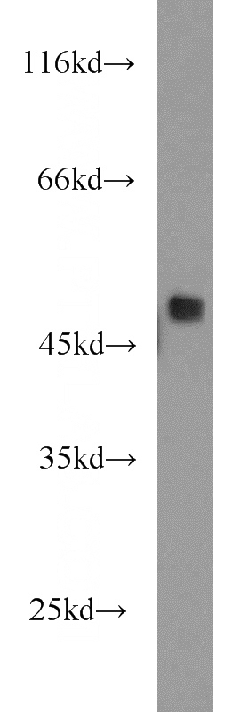 SGC-7901 cells were subjected to SDS PAGE followed by western blot with Catalog No:114613(RBM41 antibody) at dilution of 1:1500