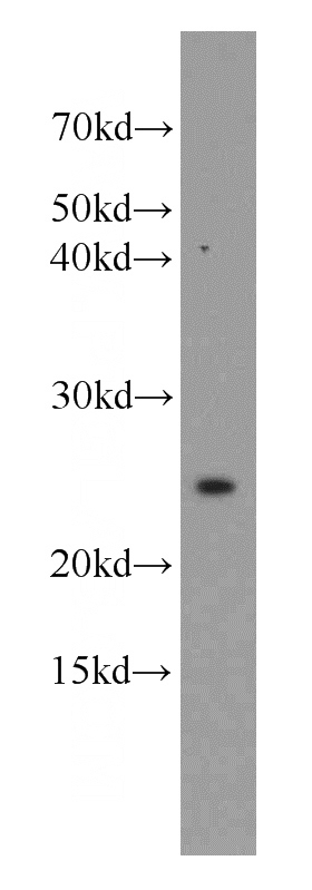 Jurkat cells were subjected to SDS PAGE followed by western blot with Catalog No:116537(UBE2T antibody) at dilution of 1:800