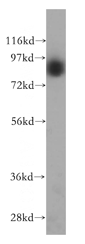 MCF7 cells were subjected to SDS PAGE followed by western blot with Catalog No:110959(GGCX antibody) at dilution of 1:2000