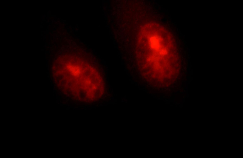 Immunofluorescent analysis of HepG2 cells, using HELLS antibody Catalog No:111400 at 1:25 dilution and Rhodamine-labeled goat anti-rabbit IgG (red).