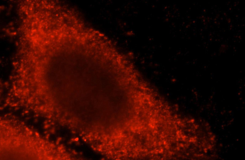 Immunofluorescent analysis of HepG2 cells, using CNOT10 antibody Catalog No:109432 at 1:25 dilution and Rhodamine-labeled goat anti-rabbit IgG (red).