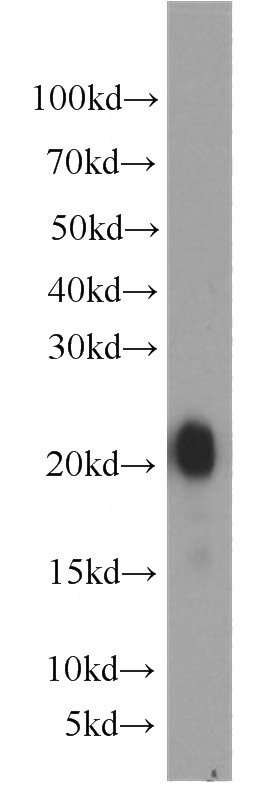 human stomach tissue were subjected to SDS PAGE followed by western blot with Catalog No:110877(GKN1 antibody) at dilution of 1:2000