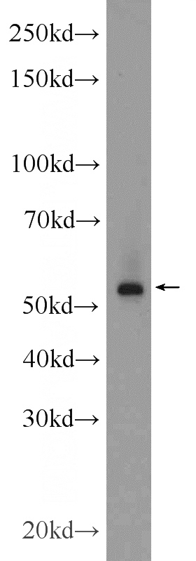 MCF-7 cells were subjected to SDS PAGE followed by western blot with Catalog No:110355(ERG Antibody) at dilution of 1:600