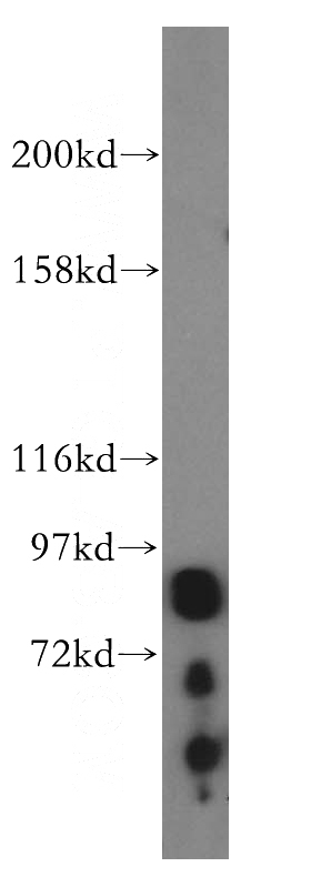 mouse brain tissue were subjected to SDS PAGE followed by western blot with Catalog No:113343(OPHN1 antibody) at dilution of 1:500