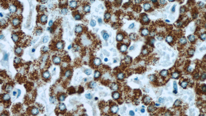 Immunohistochemical of paraffin-embedded human liver using Catalog No:115326(SLC25A2 antibody) at dilution of 1:50 (under 40x lens)