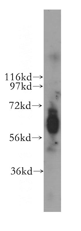 mouse skeletal muscle tissue were subjected to SDS PAGE followed by western blot with Catalog No:113276(NRF1 antibody) at dilution of 1:400