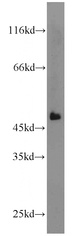 mouse liver tissue were subjected to SDS PAGE followed by western blot with Catalog No:115404(SMU1 antibody) at dilution of 1:1000
