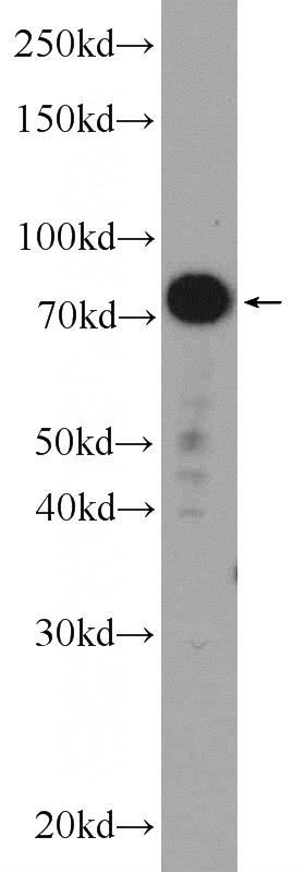 mouse colon tissue were subjected to SDS PAGE followed by western blot with Catalog No:112309(LPP Antibody) at dilution of 1:2000