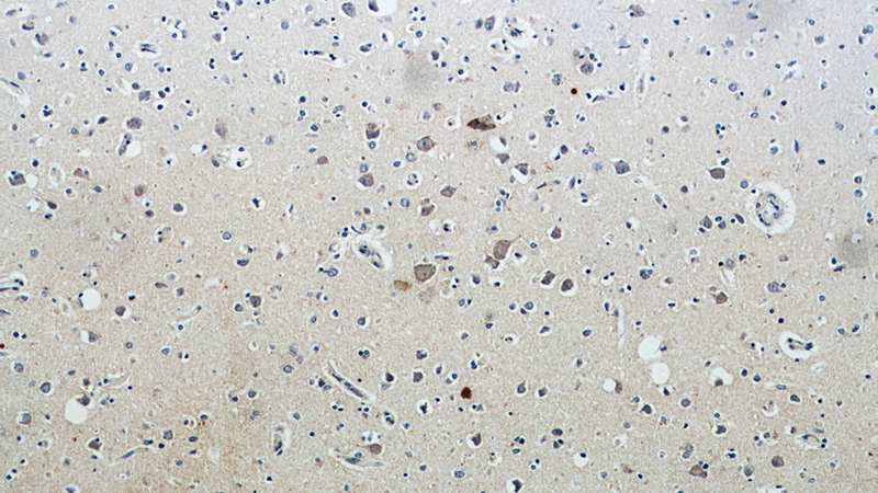Immunohistochemical of paraffin-embedded human brain using Catalog No:108710(CTA-216E10.6 antibody) at dilution of 1:100 (under 10x lens)