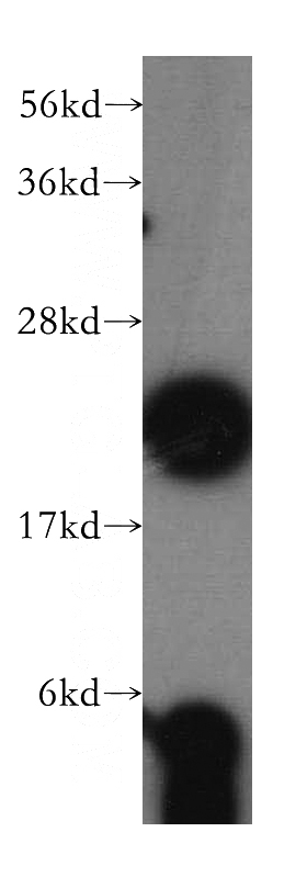 Jurkat cells were subjected to SDS PAGE followed by western blot with Catalog No:114873(RPL18A antibody) at dilution of 1:500