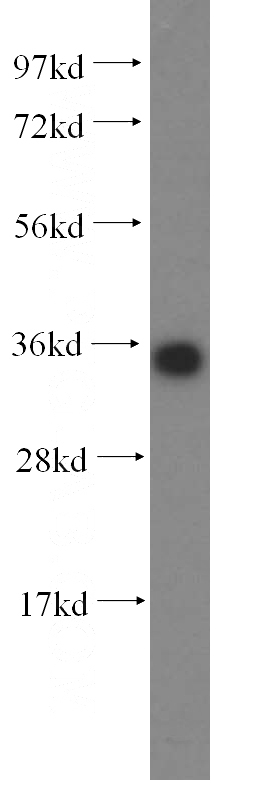 HeLa cells were subjected to SDS PAGE followed by western blot with Catalog No:111969(KCNJ15 antibody) at dilution of 1:500