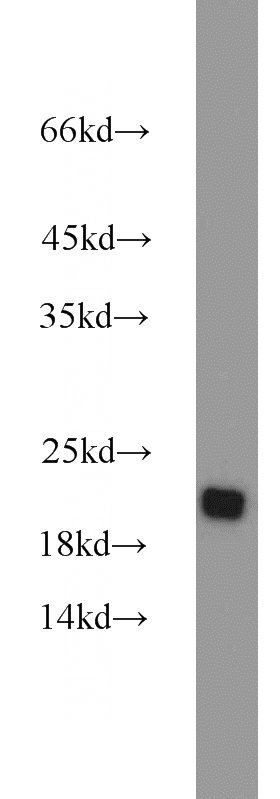 mouse thymus tissue were subjected to SDS PAGE followed by western blot with Catalog No:114640(RGS10 antibody) at dilution of 1:600