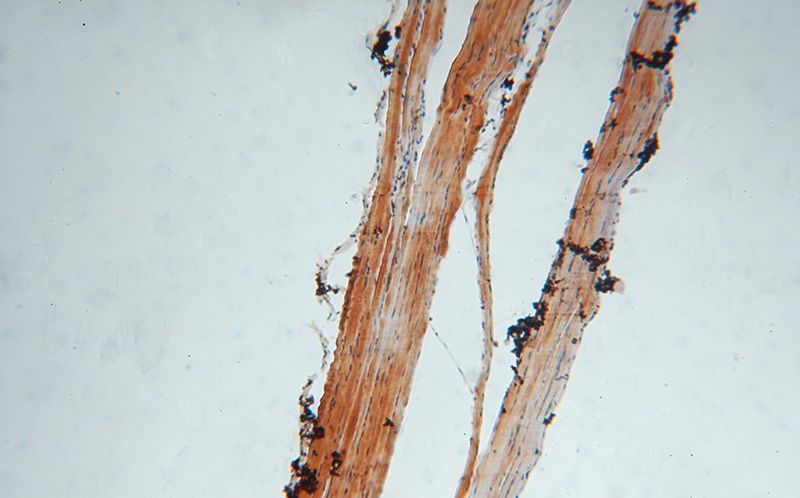 Immunohistochemical of paraffin-embedded human skeletal muscle using Catalog No:115339(SLC25A6-Specific antibody) at dilution of 1:100 (under 10x lens)