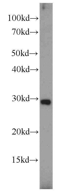 MCF7 cells were subjected to SDS PAGE followed by western blot with Catalog No:113892(PGF antibody) at dilution of 1:300