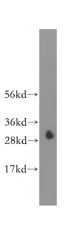 human kidney tissue were subjected to SDS PAGE followed by western blot with Catalog No:108751(CA7 antibody) at dilution of 1:400