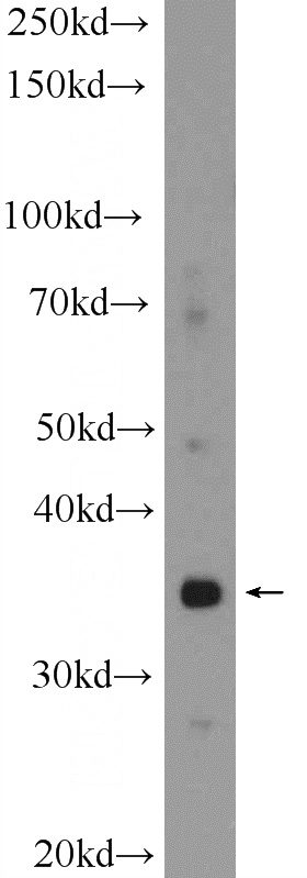 COLO 320 cells were subjected to SDS PAGE followed by western blot with Catalog No:110457(FAM105A Antibody) at dilution of 1:300