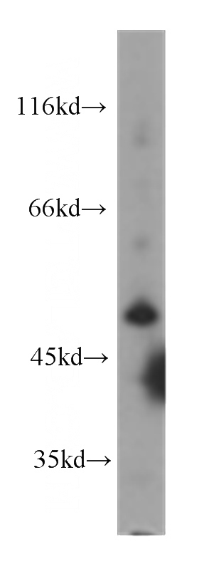 HepG2 cells were subjected to SDS PAGE followed by western blot with Catalog No:107054(AGT antibody) at dilution of 1:1000