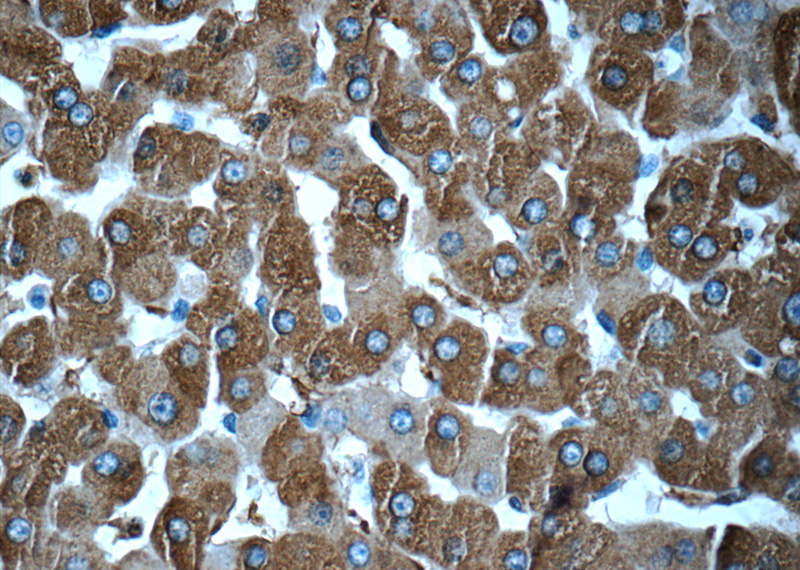 Immunohistochemistry of paraffin-embedded human liver tissue slide using Catalog No:110622(FTL Antibody) at dilution of 1:50 (under 40x lens)