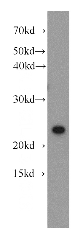 K-562 cells were subjected to SDS PAGE followed by western blot with Catalog No:112722(MOBKL3 antibody) at dilution of 1:200