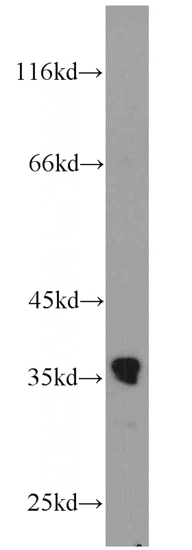 mouse kidney tissue were subjected to SDS PAGE followed by western blot with Catalog No:115325(SLC25A18 antibody) at dilution of 1:1000