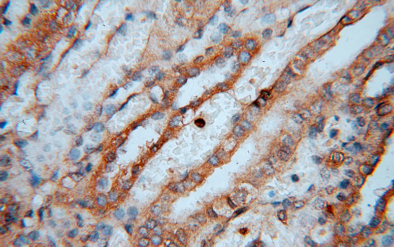 Immunohistochemical of paraffin-embedded human kidney using Catalog No:109843(DEAF1 antibody) at dilution of 1:50 (under 40x lens)