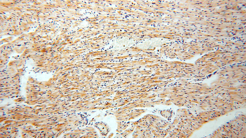 Immunohistochemical of paraffin-embedded human heart using Catalog No:107745(ACOT2 antibody) at dilution of 1:100 (under 10x lens)