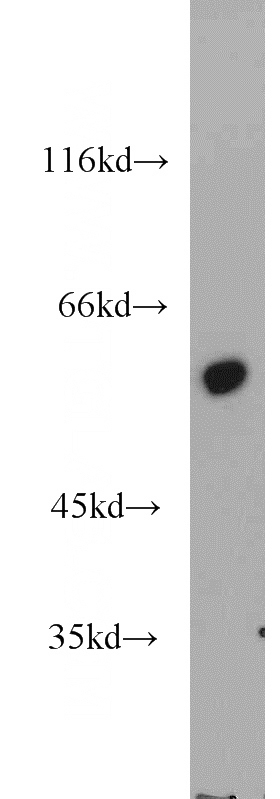 SGC-7901 cells were subjected to SDS PAGE followed by western blot with Catalog No:110561(FBXW11 antibody) at dilution of 1:2000