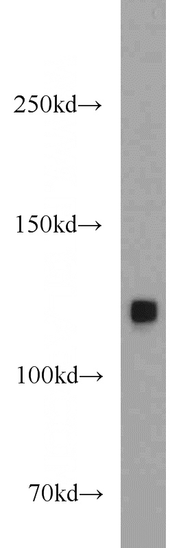 HepG2 cells were subjected to SDS PAGE followed by western blot with Catalog No:115429(SMARCA5 antibody) at dilution of 1:800
