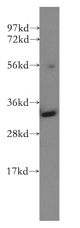 K-562 cells were subjected to SDS PAGE followed by western blot with Catalog No:111008(GNPDA1 antibody) at dilution of 1:400