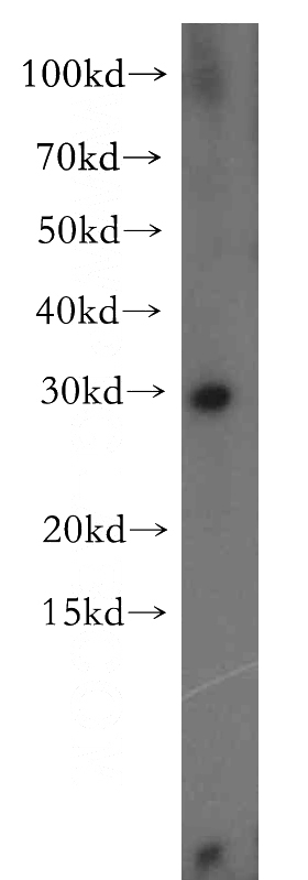 BxPC-3 cells were subjected to SDS PAGE followed by western blot with Catalog No:108941(CBR4 antibody) at dilution of 1:500