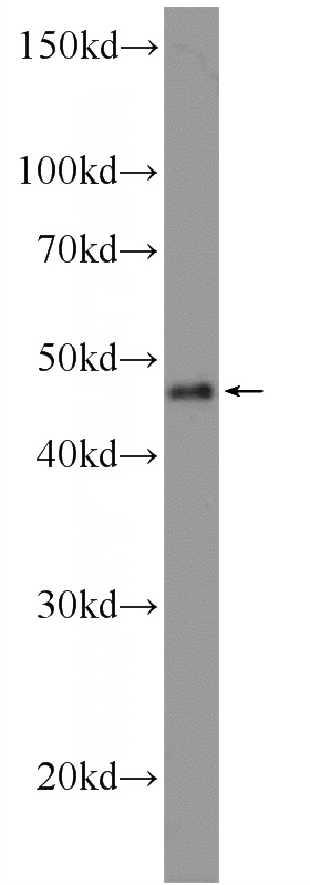 A375 cells were subjected to SDS PAGE followed by western blot with Catalog No:116002(TFAP2E Antibody) at dilution of 1:600