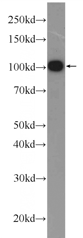 PC-3 cells were subjected to SDS PAGE followed by western blot with Catalog No:108625(C19orf57 Antibody) at dilution of 1:1000