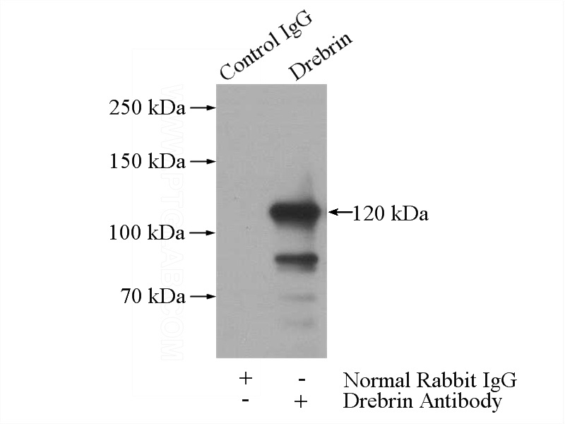 IP Result of anti-Drebrin (IP:Catalog No:110019, 4ug; Detection:Catalog No:110019 1:2000) with K-562 cells lysate 1200ug.