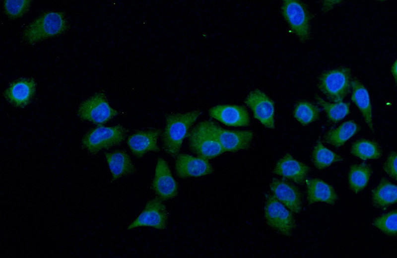 Immunofluorescent analysis of MCF-7 cells using Catalog No:110619(FER Antibody) at dilution of 1:50 and Alexa Fluor 488-congugated AffiniPure Goat Anti-Rabbit IgG(H+L)
