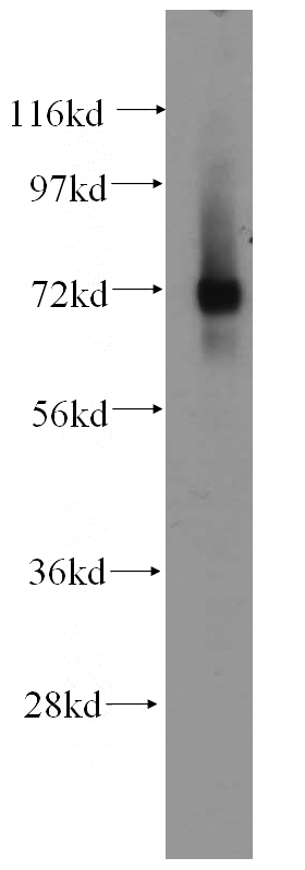K-562 cells were subjected to SDS PAGE followed by western blot with Catalog No:111636(IGSF8 antibody) at dilution of 1:500