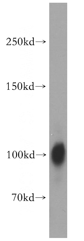 mouse brain tissue were subjected to SDS PAGE followed by western blot with Catalog No:109991(DLG3 antibody) at dilution of 1:1000
