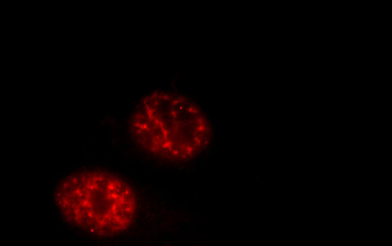 Immunofluorescent analysis of HepG2 cells, using RPRD1A antibody Catalog No:113537 at 1:50 dilution and Rhodamine-labeled goat anti-rabbit IgG (red).